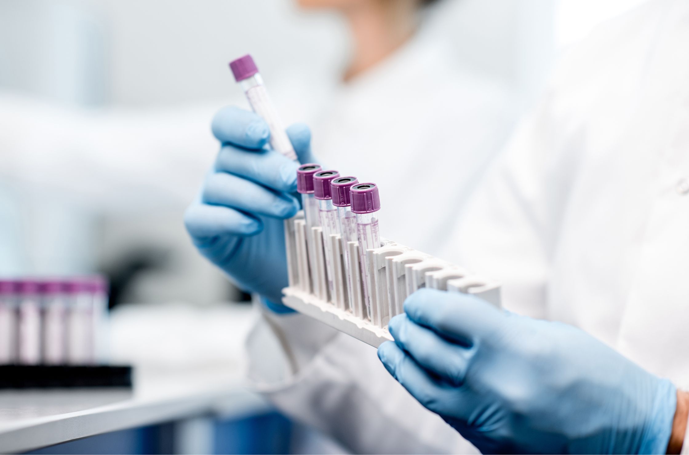 Blood tests Adelaide