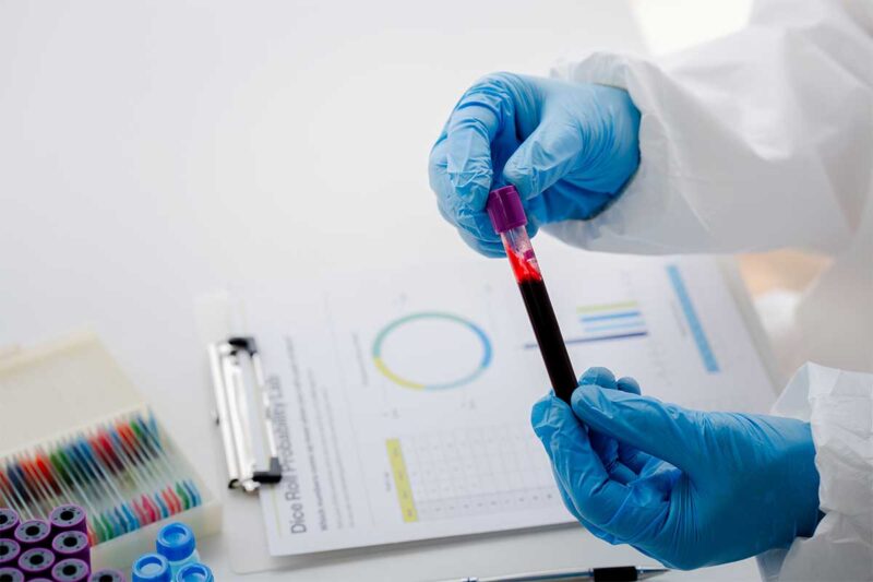Blood Test Results Explained | The Haus of Holistic Health