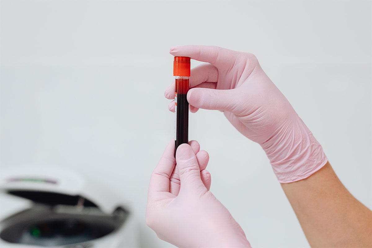 Blood Check Up Results